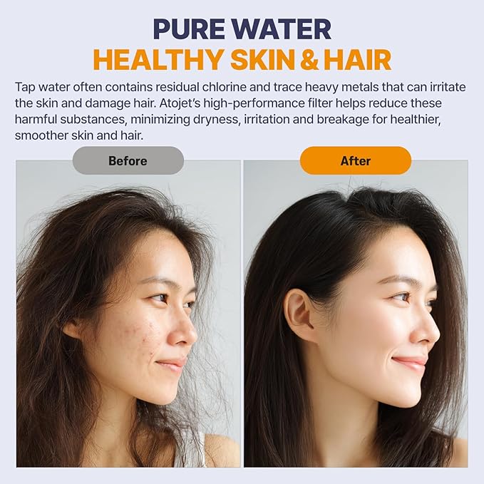 Aqua Detox Shower Filter Influenced by Korea’s Beauty Tradition - Relieves Dryness and Irritation While improving Skin and Hair Health - Black (JNE600B-SNG-DTX)